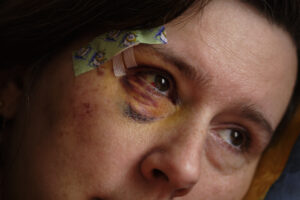 Online Vortrag über „Häusliche Gewalt im Alter“
